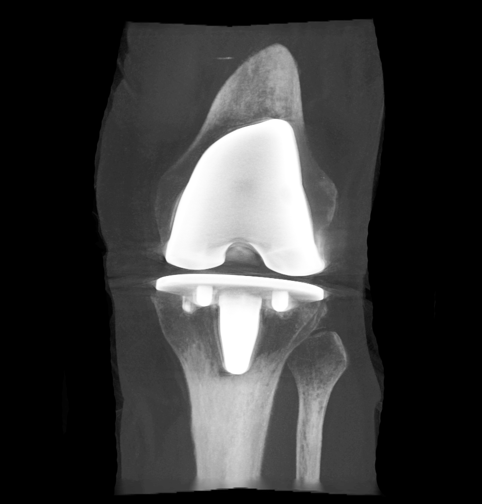 Knee 1.jpg