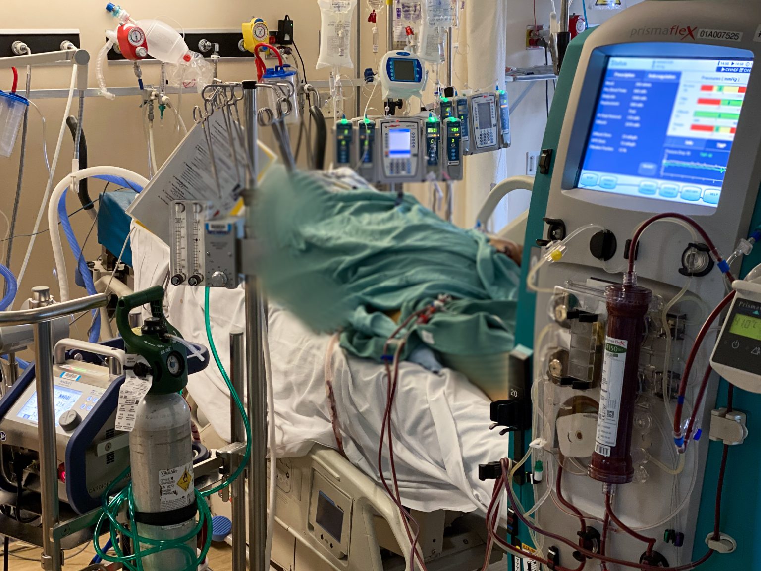 icu patient on ventilator