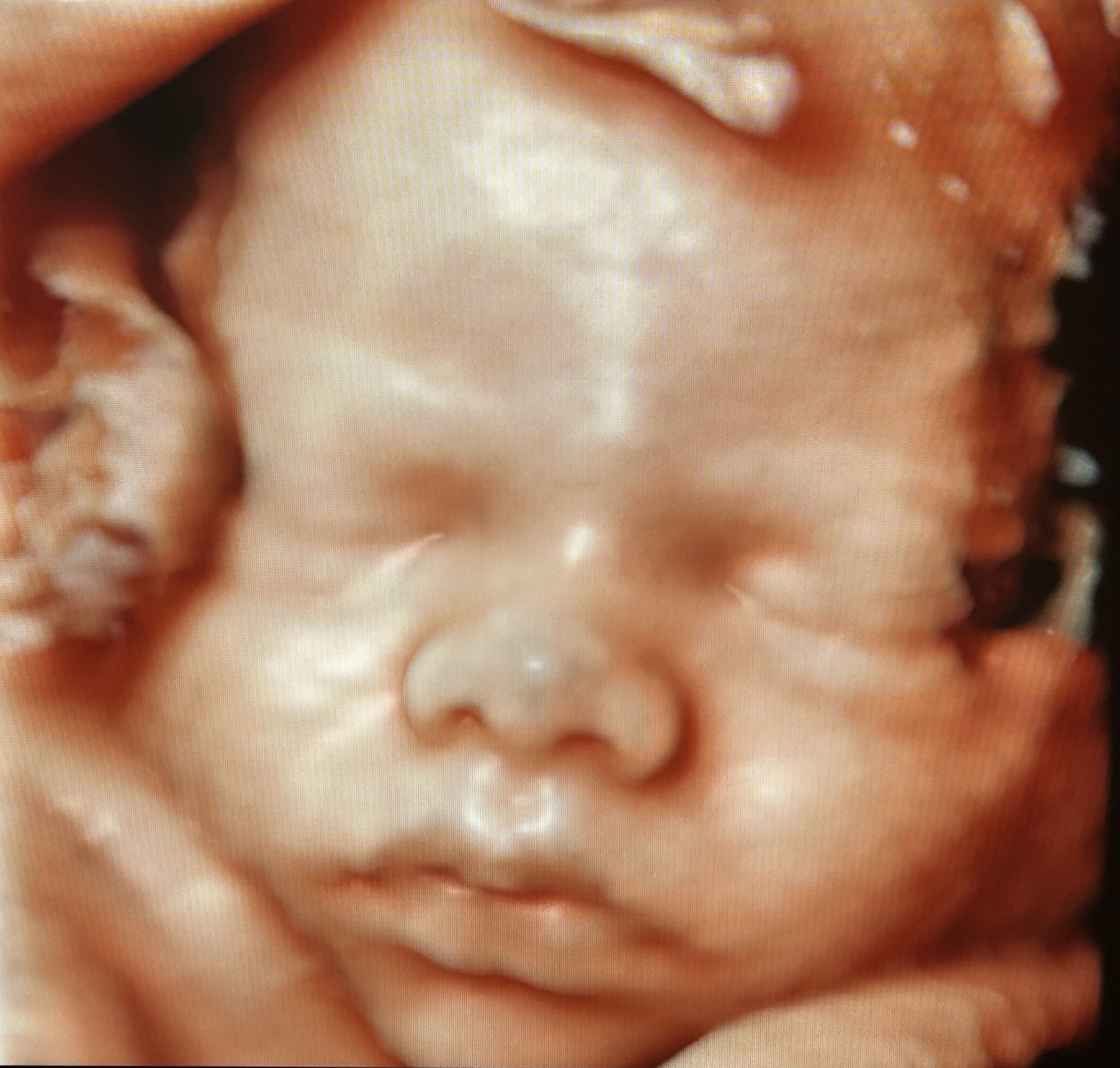 Ultrasound baby 2.jpg